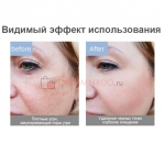 Face Skin Cleaning Scrubber ультразвуковой скраббер