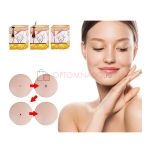 Skin Tag Patches стикеры патчи от прыщей и акне 144 шт