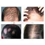 Загуститель волос Lutino Hair Building Fibers